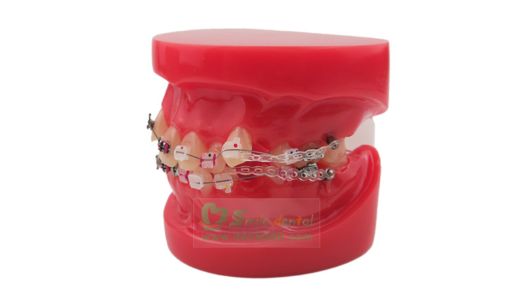 Orthodontic Model